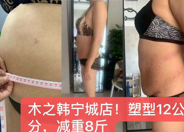 腰腹塑形一療程腰圍小了12厘米